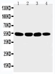 Anti-Matrilin 3/MATN3 Antibody Picoband® Boster Bio