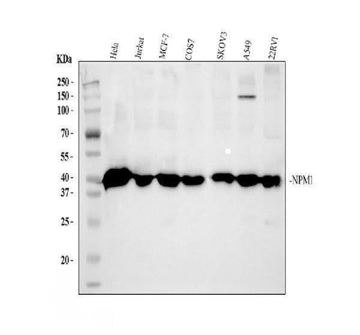 Anti-Nucleophosmin/NPM1 Antibody Picoband® Boster Bio