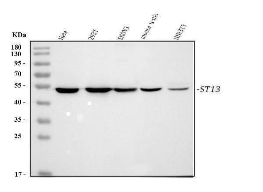 Anti-HSC70 Interacting Protein HIP/ST13 Antibody Picoband® Boster Bio