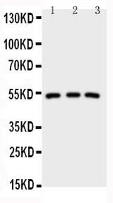 Anti-IRAK4 Antibody Picoband® Boster Bio