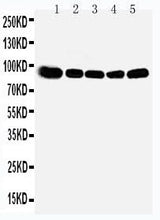 Anti-OSBP1 Antibody Picoband® Boster Bio