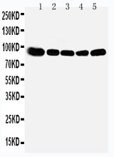 Anti-OSBP1 Antibody Picoband® Boster Bio
