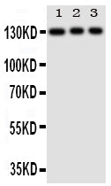Anti-Toll-like receptor 10 TLR10 Antibody Picoband® Boster Bio