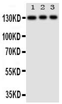Anti-Toll-like receptor 10 TLR10 Antibody Picoband® Boster Bio