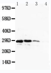 Anti-CUEDC2 Antibody Picoband® Boster Bio