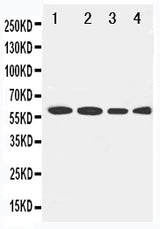 Anti-LCAT Antibody Picoband® Boster Bio