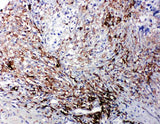 Anti-LTBR Antibody Picoband® Boster Bio