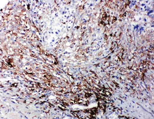 Anti-LTBR Antibody Picoband® Boster Bio
