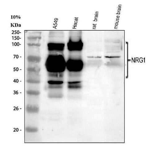 Anti-NRG1 Antibody Picoband® Boster Bio
