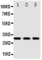 Anti-DR4/TNFRSF10A Antibody Picoband® Boster Bio
