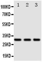 Anti-DR4/TNFRSF10A Antibody Picoband® Boster Bio