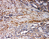 Anti-VRL1/TRPV2 Antibody Picoband® Boster Bio