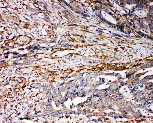 Anti-VRL1/TRPV2 Antibody Picoband® Boster Bio
