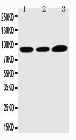 Anti-TRPV3 Antibody Picoband® Boster Bio