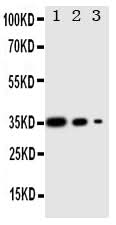 Anti-Protein Wnt-2b Wnt2b Antibody Picoband® Boster Bio