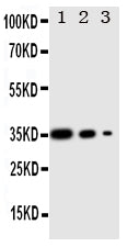 Anti-Protein Wnt-2b Wnt2b Antibody Picoband® Boster Bio