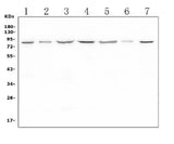 Anti-LTK Antibody Picoband® Boster Bio