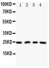 Anti-Nucleoplasmin-2 NPM2 Antibody Picoband® Boster Bio