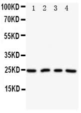 Anti-Nucleoplasmin-2 NPM2 Antibody Picoband® Boster Bio