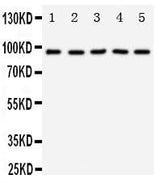 Anti-TrkC/NTRK3 Antibody Picoband® Boster Bio