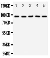 Anti-TrkC/NTRK3 Antibody Picoband® Boster Bio