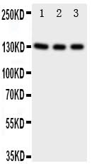 Anti-TrkC/NTRK3 Antibody Picoband® Boster Bio