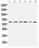 Anti-Mitochondrial Pyruvate dehydrogenase kinase 1/PDK1 Antibody Picoband® Boster Bio
