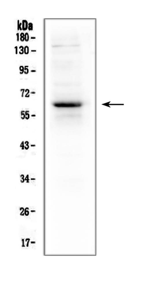 Anti-T-bet/Tbx21 Antibody Picoband® Boster Bio