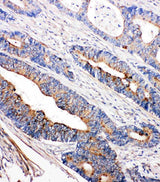 Anti-Tyrosine-protein kinase Tec Tec Antibody Picoband® Boster Bio