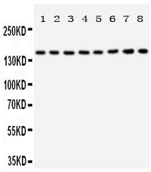 Anti-Hamartin/TSC1 Antibody Picoband® Boster Bio
