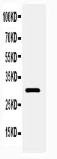 Anti-Adiponectin/ADIPOQ Antibody Picoband® Boster Bio