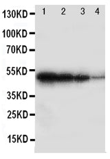 Anti-BMPR1B Antibody Picoband® Boster Bio