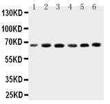 Anti-CETP Antibody Picoband® Boster Bio