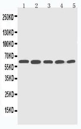 Anti-Cytochrome P450 2U1 CYP2U1 Antibody Picoband® Boster Bio