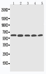 Anti-Cytochrome P450 2U1 CYP2U1 Antibody Picoband® Boster Bio