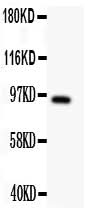Anti-DISC1 Antibody Picoband® Boster Bio