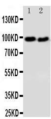 Anti-DISC1 Antibody Picoband® Boster Bio
