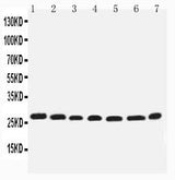 Anti-integrin beta 4 binding protein/EIF6 Antibody Picoband® Boster Bio