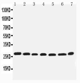 Anti-integrin beta 4 binding protein/EIF6 Antibody Picoband® Boster Bio