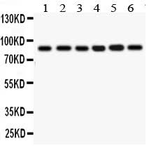 Anti-IKK beta/IKBKB Antibody Picoband® Boster Bio