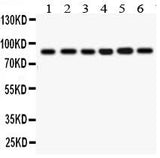 Anti-IKK beta/IKBKB Antibody Picoband® Boster Bio
