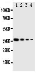 Anti-NTAL/LAT2 Antibody Picoband® Boster Bio
