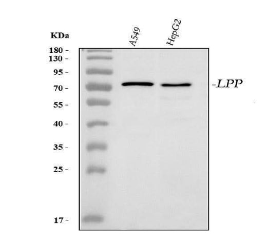 Anti-Lipoma-preferred partner LPP Antibody Picoband® Boster Bio