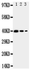 Anti-MBD4 Antibody Picoband® Boster Bio