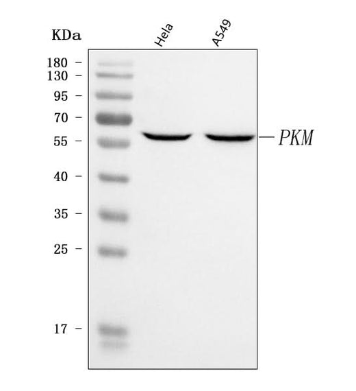 Anti-PKM2 Antibody Picoband® Boster Bio