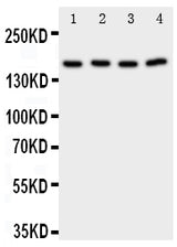 Anti-Phospholipase A2/PLA2G4A Antibody Picoband® Boster Bio