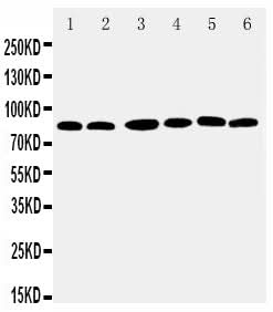 Anti-RSK1 p90/RPS6KA1 Antibody Picoband® Boster Bio