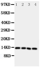 Anti-Somatostatin/SST Antibody Picoband® Boster Bio