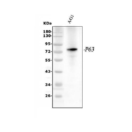 Anti-p63/TP63 Antibody Picoband® Boster Bio