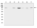 Anti-Factor VIII/F8 Antibody Picoband® Boster Bio